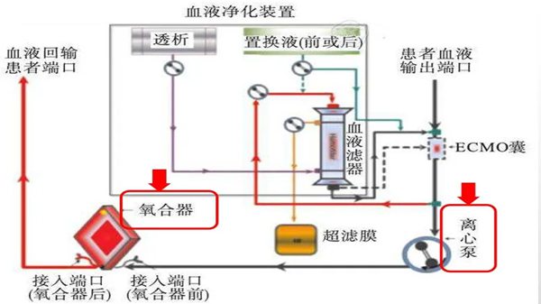 ECMO是甚么意义,ecmo英语怎样读,ecmo为甚么这么贵